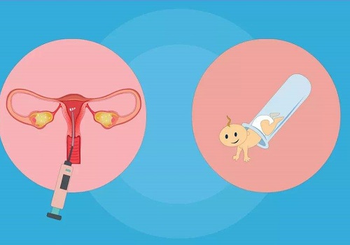 試管嬰兒的條件是什么？50歲失獨能做嗎？