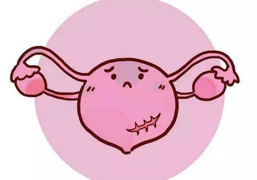 試管洗精術(shù)的費(fèi)用是多少？促排方案怎么選？